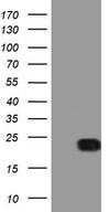 HEK293T cells were transfected with the pCMV6-ENTRY control (Left lane) or pCMV6-ENTRY RHOC (Right lane) cDNA for 48 hrs and lysed. Equivalent amounts of cell lysates (5 ug per lane) were separated by SDS-PAGE and immunoblotted with anti-RHOC.