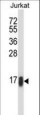 RHOC Antibody western blot of Jurkat cell line lysates (35 ug/lane). The RHOC antibody detected the RHOC protein (arrow).