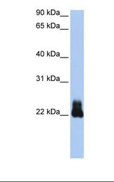 Transfected 293T cell lysate. Antibody concentration: 1.0 ug/ml. Gel concentration: 12%.