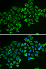 Immunofluorescence analysis of MCF-7 cell using RHOD antibody. Blue: DAPI for nuclear staining.