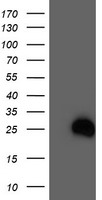 HEK293T cells were transfected with the pCMV6-ENTRY control (Left lane) or pCMV6-ENTRY RHOD (Right lane) cDNA for 48 hrs and lysed. Equivalent amounts of cell lysates (5 ug per lane) were separated by SDS-PAGE and immunoblotted with anti-RHOD.