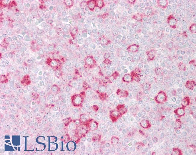 Anti-RHOD antibody IHC of human tonsil. Immunohistochemistry of formalin-fixed, paraffin-embedded tissue after heat-induced antigen retrieval. Antibody LS-B6828 concentration 5 ug/ml.