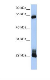 Transfected 293T cell lysate. Antibody concentration: 1.0 ug/ml. Gel concentration: 12%.