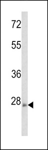 Western blot of ARHE Antibody in mouse brain tissue lysates (35 ug/lane). ARHE (arrow) was detected using the purified antibody.