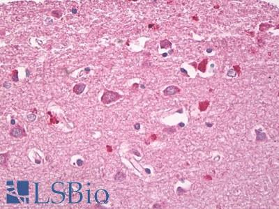 Human, Brain, Cortex: Formalin-Fixed Paraffin-Embedded (FFPE)