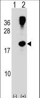 Western blot of RHOG (arrow) using rabbit polyclonal RHOG Antibody. 293 cell lysates (2 ug/lane) either nontransfected (Lane 1) or transiently transfected (Lane 2) with the RHOG gene.