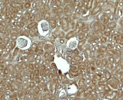 Immunohistochemistry of RHOG in mouse kidney tissue with RHOG antibody at 5 ug/ml.