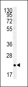 TC10 Antibody western blot of T47D cell line lysates (35 ug/lane). The TC10 antibody detected the TC10 protein (arrow).