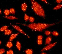 IHC of HeLa cells using anti-TC10 antibody.