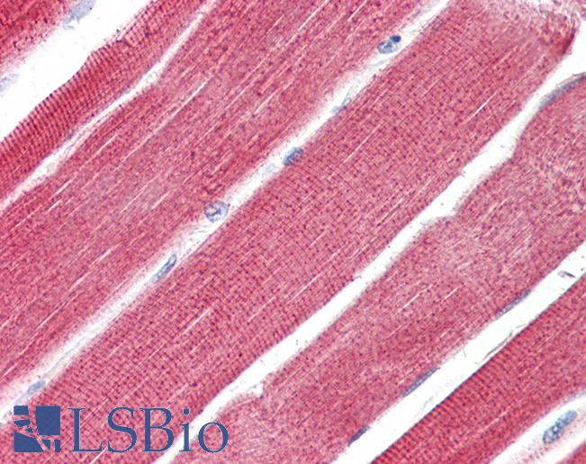 Anti-RHOT1 antibody IHC of human skeletal muscle. Immunohistochemistry of formalin-fixed, paraffin-embedded tissue after heat-induced antigen retrieval. Antibody LS-B8096 dilution 5-10 ug/ml.