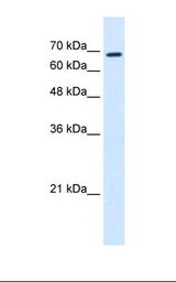 HepG2 cell lysate. Antibody concentration: 0.25 ug/ml. Gel concentration: 12%.