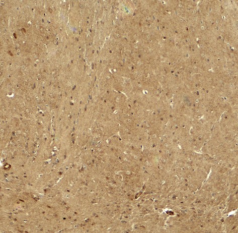 Immunohistochemistry of RHOT in mouse brain tissue with RHOT antibody at 5 ug/ml.