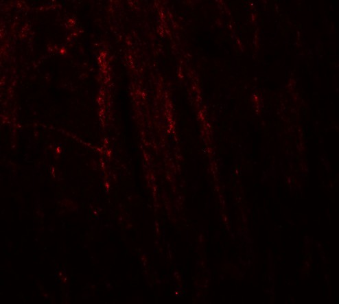 Immunofluorescence of RHOT in mouse brain tissue with RHOT antibody at 20 ug/ml.