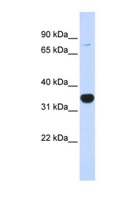 RHOT1 antibody LS-C102142 Western blot of 293T cell lysate.