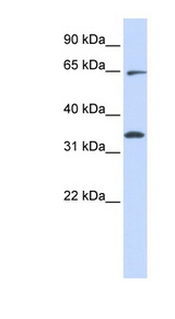 RHOT1 antibody LS-C102143 Western blot of HeLa lysate.