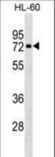 RHOT2 Antibody western blot of HL-60 cell line lysates (35 ug/lane). The RHOT2 antibody detected the RHOT2 protein (arrow).