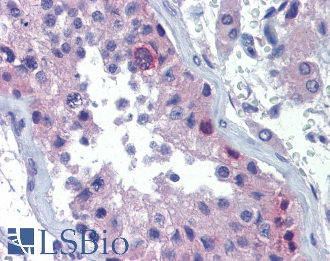 Anti-RHOXF2 antibody IHC of human testis. Immunohistochemistry of formalin-fixed, paraffin-embedded tissue after heat-induced antigen retrieval. Antibody LS-B3518 concentration 10 ug/ml.