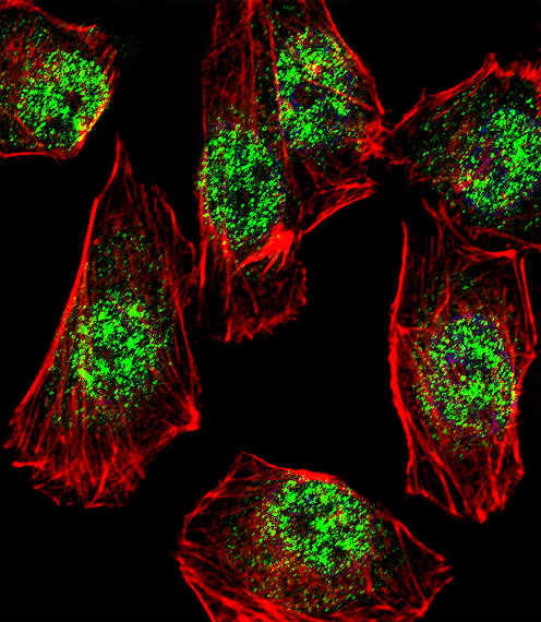 Fluorescent confocal image of A549 cell stained with RHOXF2B Antibody. A549 cells were fixed with 4% PFA (20 min), permeabilized with Triton X-100 (0.1%, 10 min), then incubated with RHOXF2B primary antibody (1:25, 1 h at 37°C). For secondary antibody, Alexa Fluor 488 conjugated donkey anti-rabbit antibody (green) was used (1:400, 50 min at 37°C). Cytoplasmic actin was counterstained with Alexa Fluor 555 (red) conjugated Phalloidin (7units/ml, 1 h at 37°C). Nuclei were counterstained with DAPI (blue) (10 ug/ml, 10 min). RHOXF2B immunoreactivity is localized to Nucleus significantly.