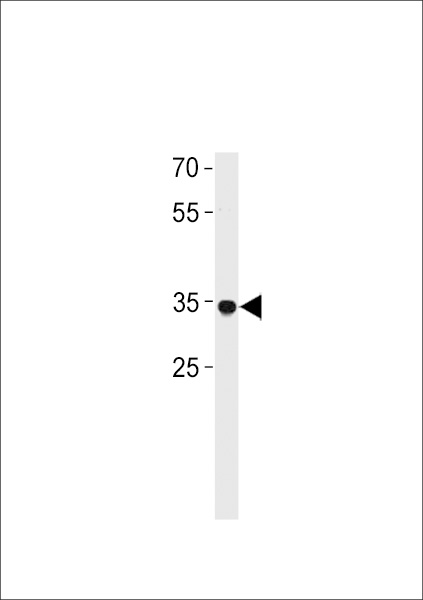 RHOXF2B Antibody western blot of A549 cell line lysates (35 ug/lane). The RHOXF2B antibody detected the RHOXF2B protein (arrow).