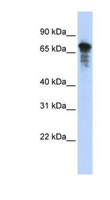 RHPN1 antibody LS-C111401 Western blot of Transfected 293T cell lysate.