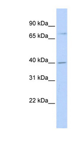 RHPN1 antibody LS-C111402 Western blot of Transfected 293T cell lysate.