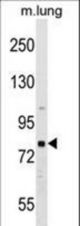 RHPN1 Antibody western blot of mouse lung tissue lysates (35 ug/lane). The RHPN1 antibody detected the RHPN1 protein (arrow).