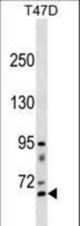 RHPN2 Antibody western blot of T47D cell line lysates (35 ug/lane). The RHPN2 antibody detected the RHPN2 protein (arrow).