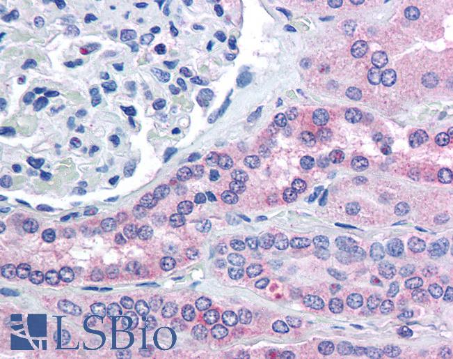 Anti-RHPN2 antibody IHC of human kidney. Immunohistochemistry of formalin-fixed, paraffin-embedded tissue after heat-induced antigen retrieval. Antibody LS-B1756 concentration 5 ug/ml.