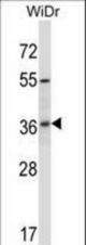 RIBC2 Antibody western blot of WiDr cell line lysates (35 ug/lane). The RIBC2 antibody detected the RIBC2 protein (arrow).
