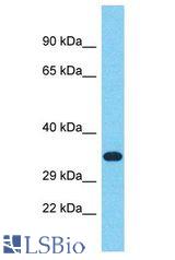 RIBC2 antibody Western Blot of 721_B. Antibody dilution: 1 ug/ml.