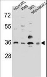 RIC3 Antibody western blot of NCI-H292,A549,WiDr,MDA-MB453 cell line lysates (35 ug/lane). The RIC3 antibody detected the RIC3 protein (arrow).