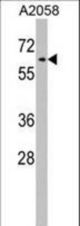 RIC8A Antibody western blot of A2058 cell line lysates (35 ug/lane). The RIC8A antibody detected the RIC8A protein (arrow).