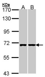 Sample (30 ug of whole cell lysate). A: A431 , B: Hela. 7.5% SDS PAGE. RIC8A antibody diluted at 1:1000.