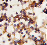 Formalin-fixed and paraffin-embedded human Lymph tissue reacted with Rictor antibody , which was peroxidase-conjugated to the secondary antibody, followed by DAB staining. This data demonstrates the use of this antibody for immunohistochemistry; clinical relevance has not been evaluated.