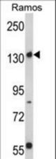 Western blot of Rictor Antibody in Ramos cell line lysates (35 ug/lane). RICTOR (arrow) was detected using the purified antibody.