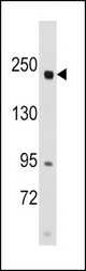 Western blot of anti-RICTOR antibody in SK-BR-3 cell line lysates (35 ug/lane). RICTOR (arrow) was detected using the purified antibody.