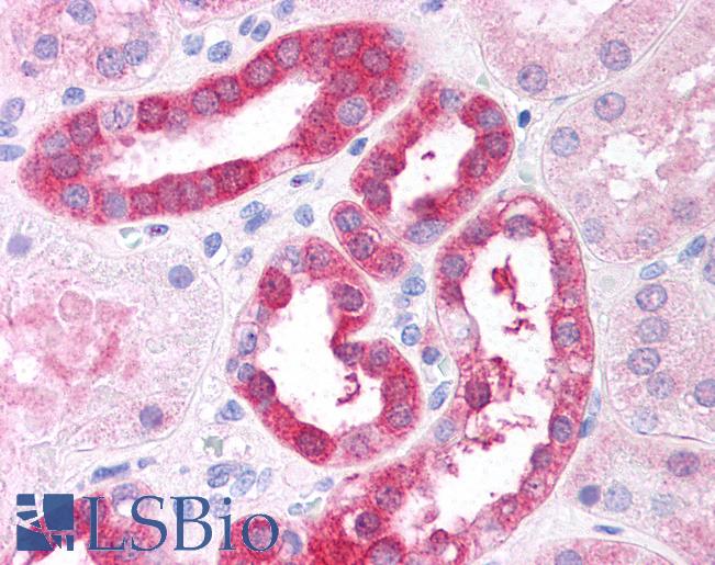 Anti-RICTOR antibody IHC of human renal tubular epithelium. Immunohistochemistry of formalin-fixed, paraffin-embedded tissue after heat-induced antigen retrieval. Antibody LS-B7 concentration 5 ug/ml.