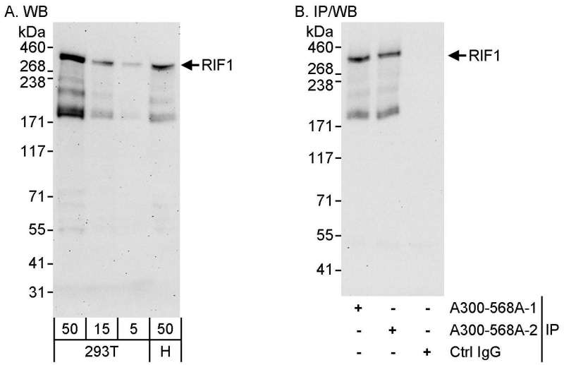 Detection of Human RIF1 by Western Blot and Immunoprecipitation. Samples: Whole cell lysate from 293T (5, 15 and 50 ug for WB; 1 mg for IP, 20% of IP loaded) and HeLa (H; 50 ug) cells. Antibodies: Affinity purified rabbit anti-RIF1 antibody used for WB at 0.1 ug/ml (A) and 1 ug/ml (B) and used for IP at 3 ug/mg lysate. RIF1 was also immunoprecipitated by the previous lot (-1) of this antibody. Detection: Chemiluminescence with exposure times of 3 minutes (A) and 30 seconds (B).
