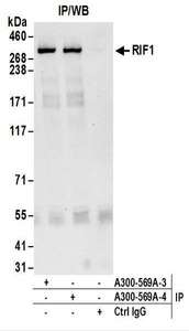 Detection of Human RIF1 by Western Blot of Immunoprecipitates. Samples: Whole cell lysate (1 mg for IP; 20% of IP loaded) from HeLa cells. Antibodies: Affinity purified rabbit anti-RIF1 antibody used for IP at 6 ug/mg lysate. RIF1 was also immunoprecipitated by a previous lot of this antibody. For blotting immunoprecipitated RIF1, -4 was used at 1 ug/ml. Detection: Chemiluminescence with an exposure time of 10 seconds.