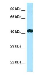 RILP antibody Western Blot of Placenta.