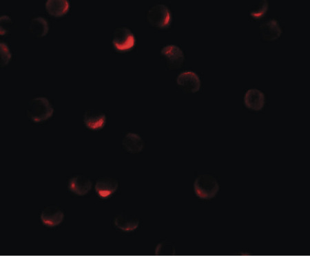 Immunofluorescence of RILP in HeLa cells with RILP antibody at 20 ug/ml.