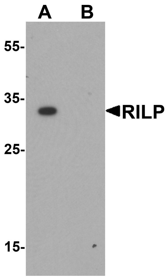 Western blot analysis of RILP in A20 cell lysate with RILP antibody at 1 ug/ml.
