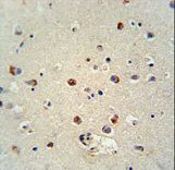 RILPL1 antibody immunohistochemistry of formalin-fixed and paraffin-embedded human brain tissue followed by peroxidase-conjugated secondary antibody and DAB staining.