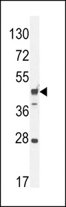 RILPL1 Antibody western blot of mouse heart tissue lysates (35 ug/lane). The RILPL1 antibody detected the RILPL1 protein (arrow).