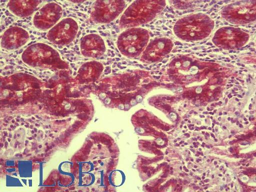 Anti-RILPL1 antibody IHC staining of human small intestine. Immunohistochemistry of formalin-fixed, paraffin-embedded tissue after heat-induced antigen retrieval. Antibody LS-B9574 concentration 5 ug/ml.