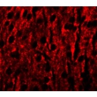 Immunofluorescence of RILPL1 in mouse brain cells with RILPL1 antibody at 20 µg/mL.
