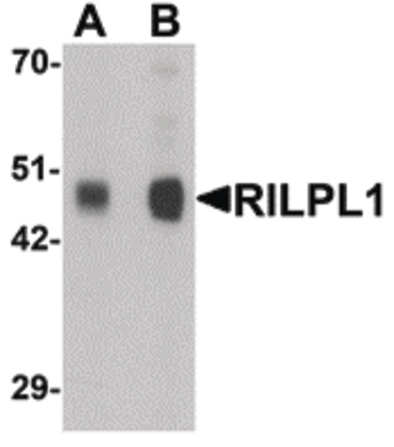 Western blot of RILPL1 in rat cerebellum tissue lysate with RILPL1 antibody at (A) 0.5 and (B) 1 ug/ml.
