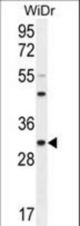 RILPL2 Antibody western blot of WiDr cell line lysates (35 ug/lane). The RILPL2 antibody detected the RILPL2 protein (arrow).