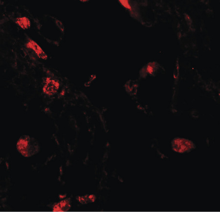 Immunofluorescence of RLP2 in human lung tissue with RLP2 antibody at 20 ug/ml.