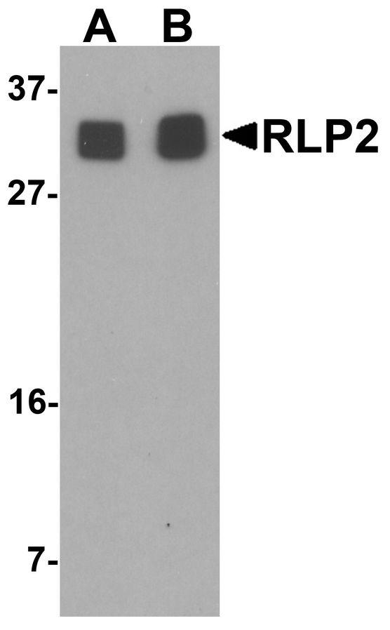 Western blot analysis of RLP2 in A549 cell lysate with RLP2 antibody at (A) 1 and (B) 2 ug/ml.